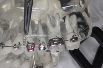 Dental Assisting Course: How to set up and assist for Orthodontic Procedures: 14 days to Demystifying Orthodontic Procedures (DA_M7_