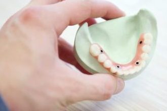 Dental Assisting Course: How to set up and assist for Removable Prosthodontics (Dentures, Splints, Mouthguards, Bleach Trays): (DA_M8)